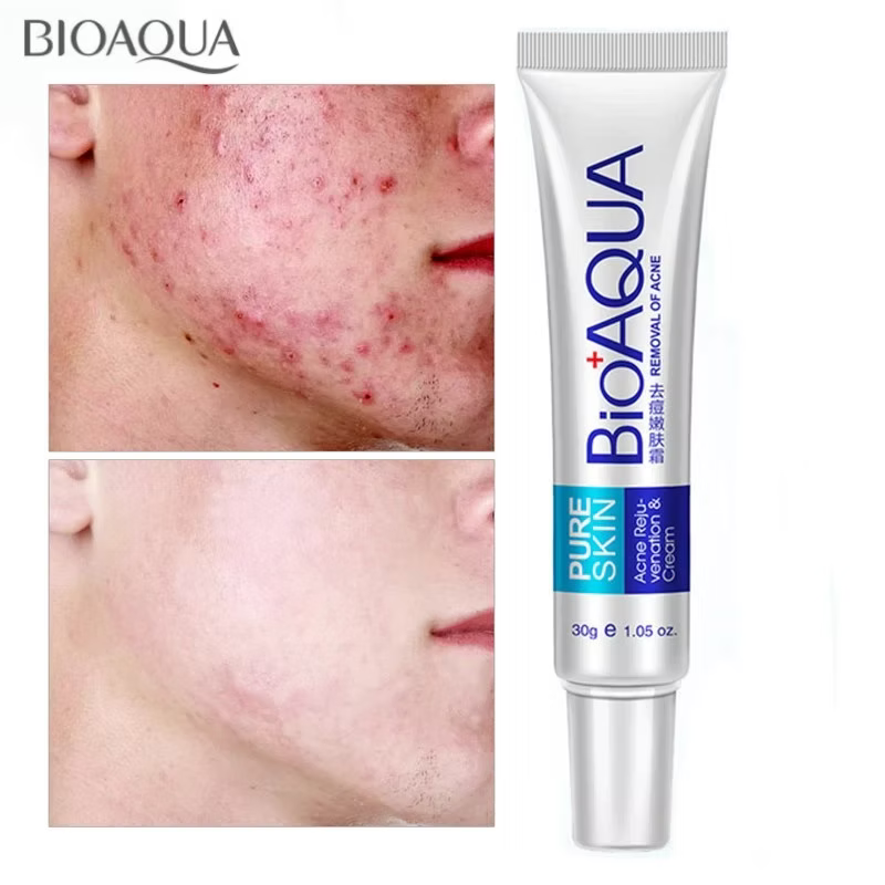 BIOAQUA CREMA ANTIACNÉ