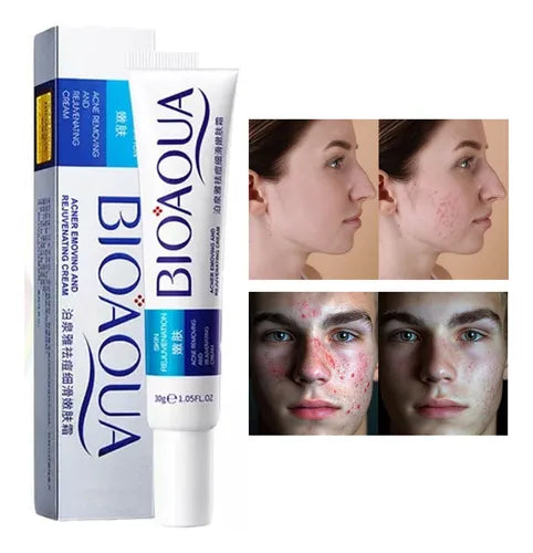 BIOAQUA CREMA ANTIACNÉ