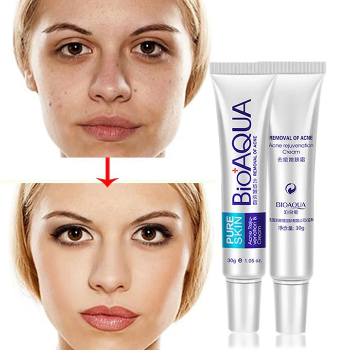 BIOAQUA CREMA ANTIACNÉ